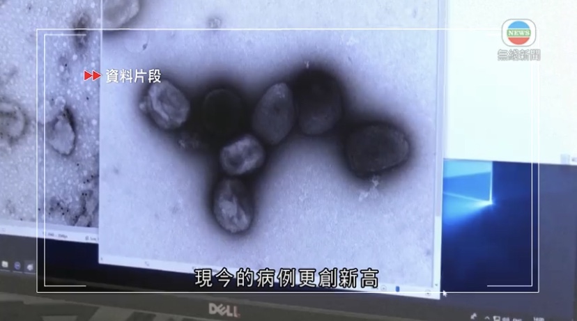  🔵新加坡发现首宗本土确诊猴痘病例世卫对病毒传播规模持续感担忧