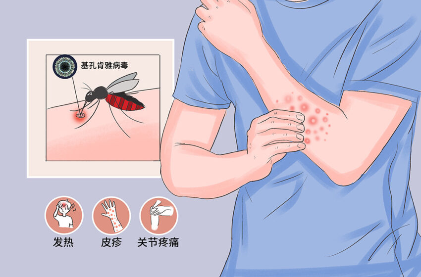  基孔肯雅热疫情：134例确诊感染报告，通报一例死亡病例